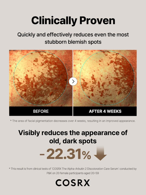 COSRX The Alpha-Arbutin 2 Discoloration Care Serum sukinnaturals sukinnaturals.com.au